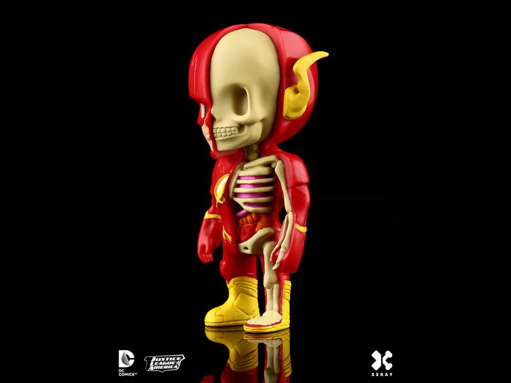DC Comics XXRAY The Flash Figure Gallery Image 4