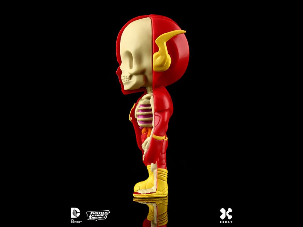 DC Comics XXRAY The Flash Figure Gallery Image 6